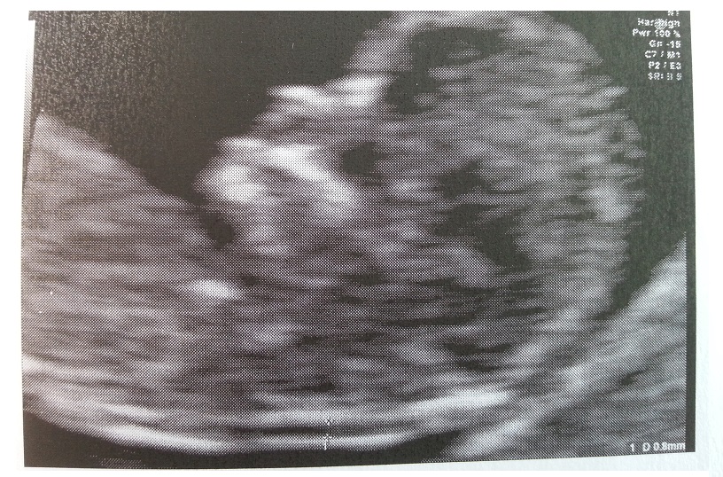 duotest_testaprofilo